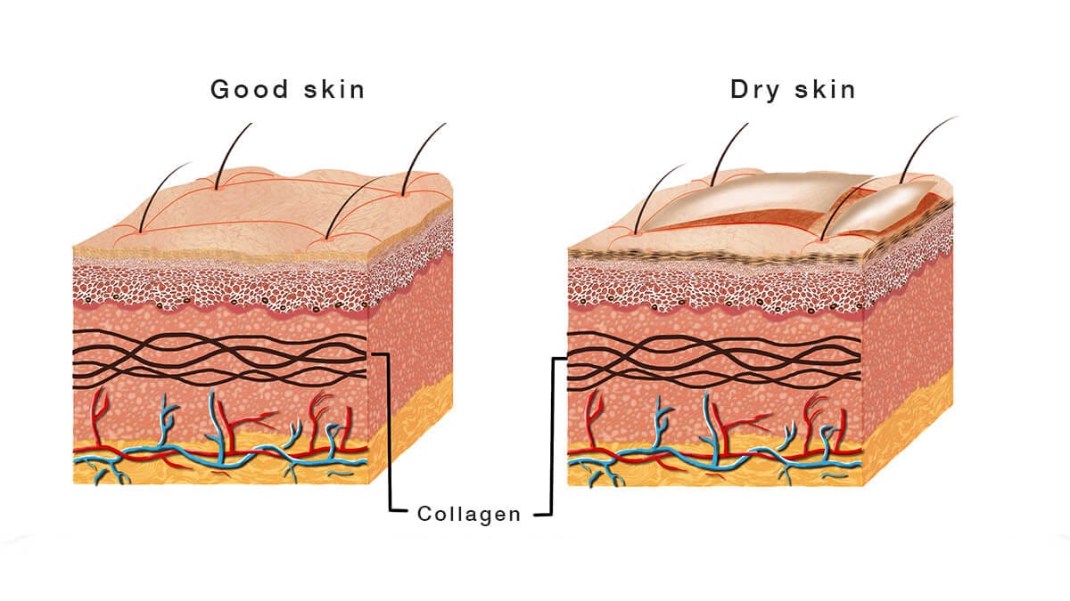 Scrub Wajah Kulit Kering: Kenali Penyebab dan Bahan Alami Untuk Exfoliating