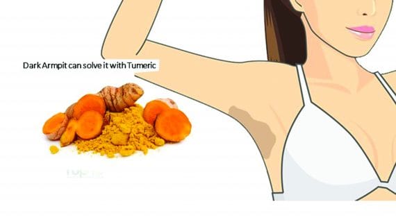 Pemutih Ketiak Alami Menggunakan Kunyit + Review Produk