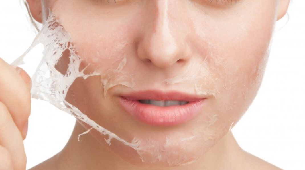 Penyebab kulit wajah kusam dan cara mengatasinya - kurang eksfoliasi