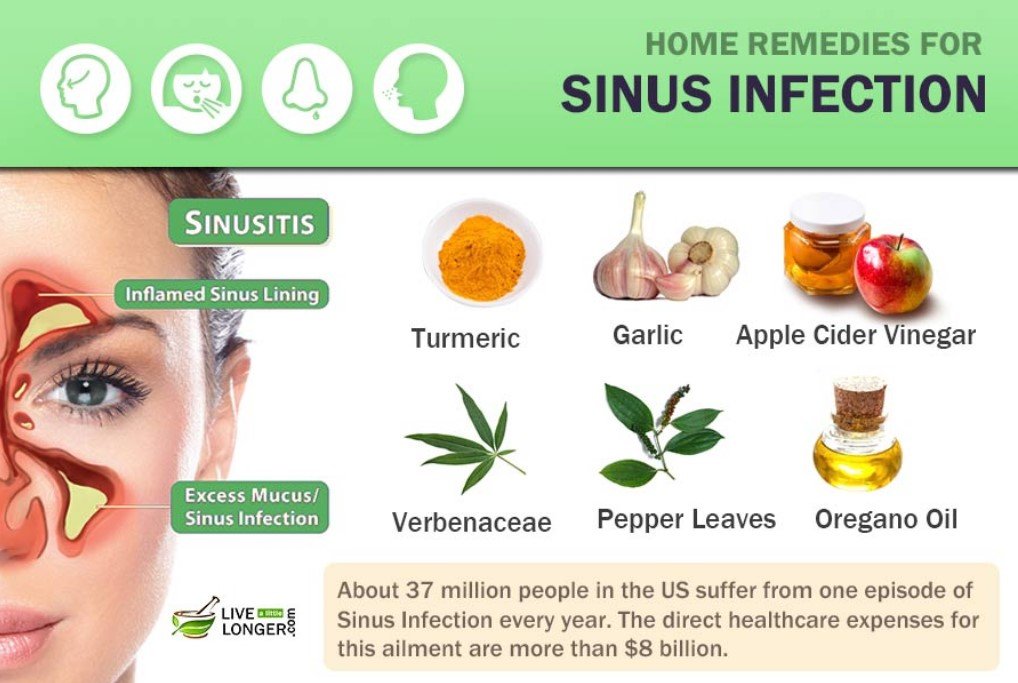 Pengobatan Alami untuk Penyakit Sinusitis